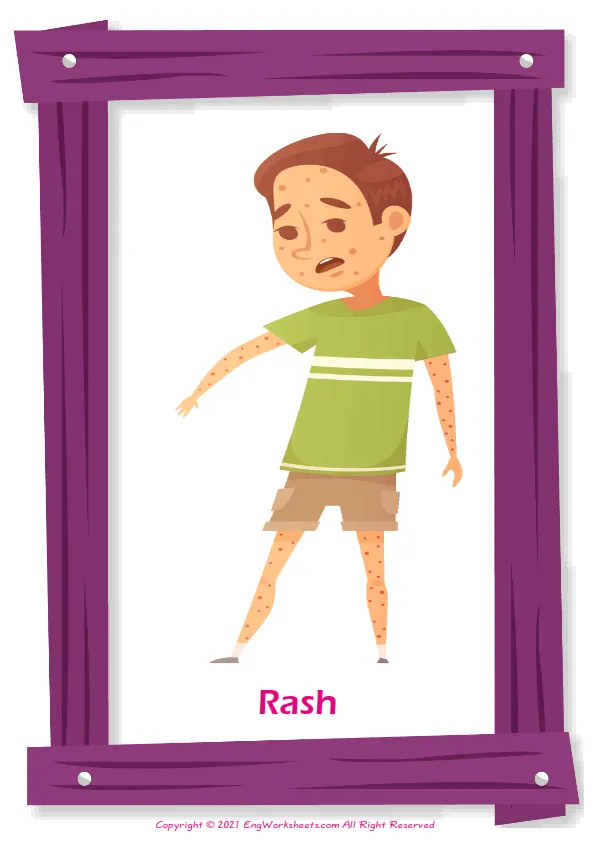 Kids Diseases English vocabulary worksheet with full-page words