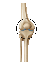 Patella